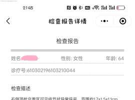 21突变 特罗凯5年5个月后奥西不到一年，脑转进展，该何去何从