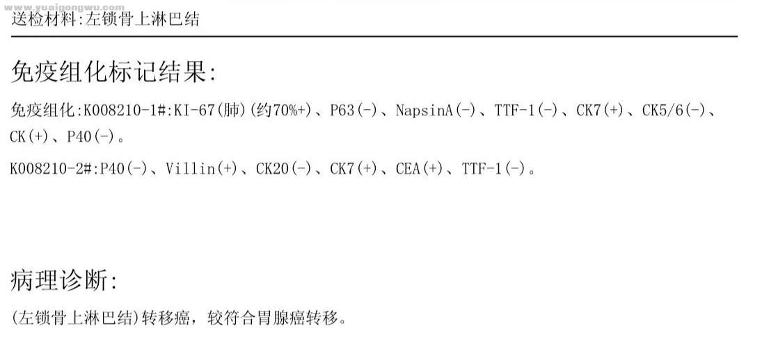 左锁骨上淋巴结免疫组化结果